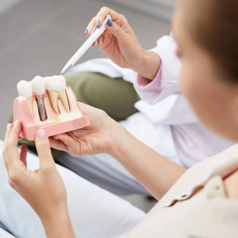 Implants and Oral Surgery London